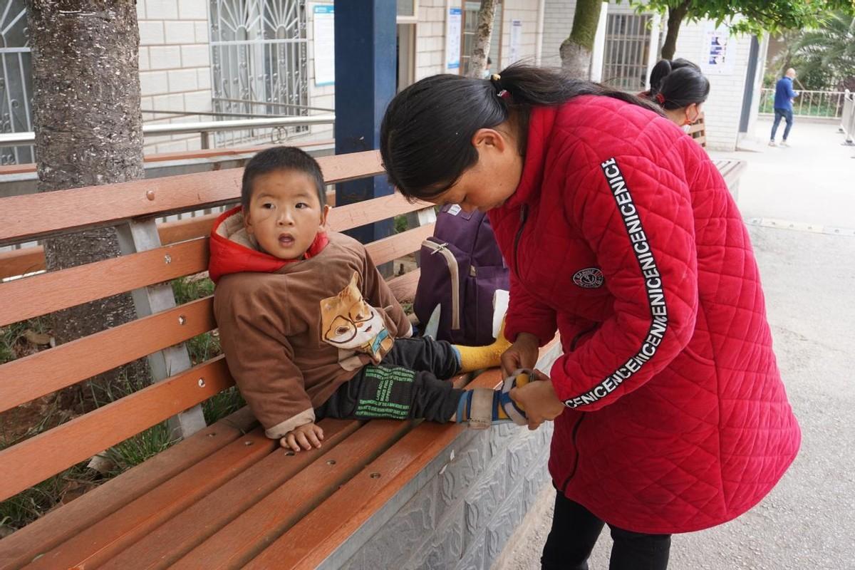 三个月宝宝脑积水症状解析