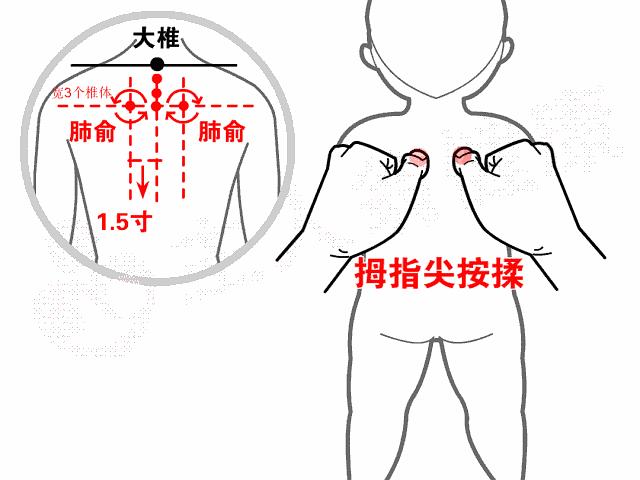 三个月宝宝咳嗽不发烧，原因、应对与注意事项