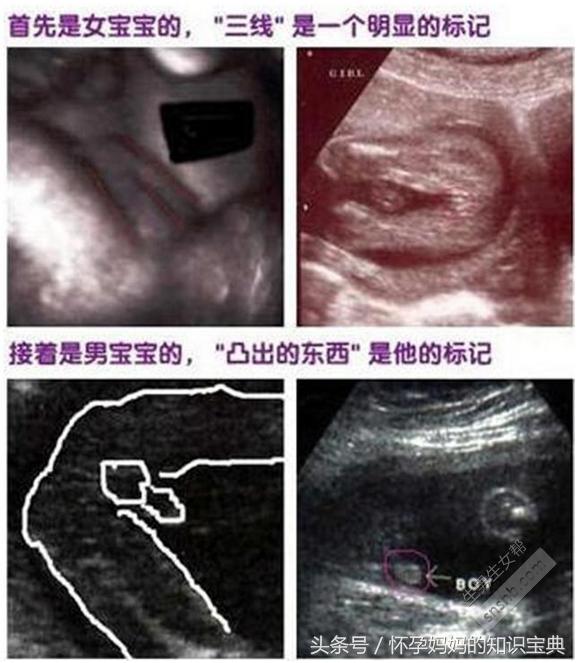 半个月孕囊生长研究，揭秘胚胎早期发育的奥秘