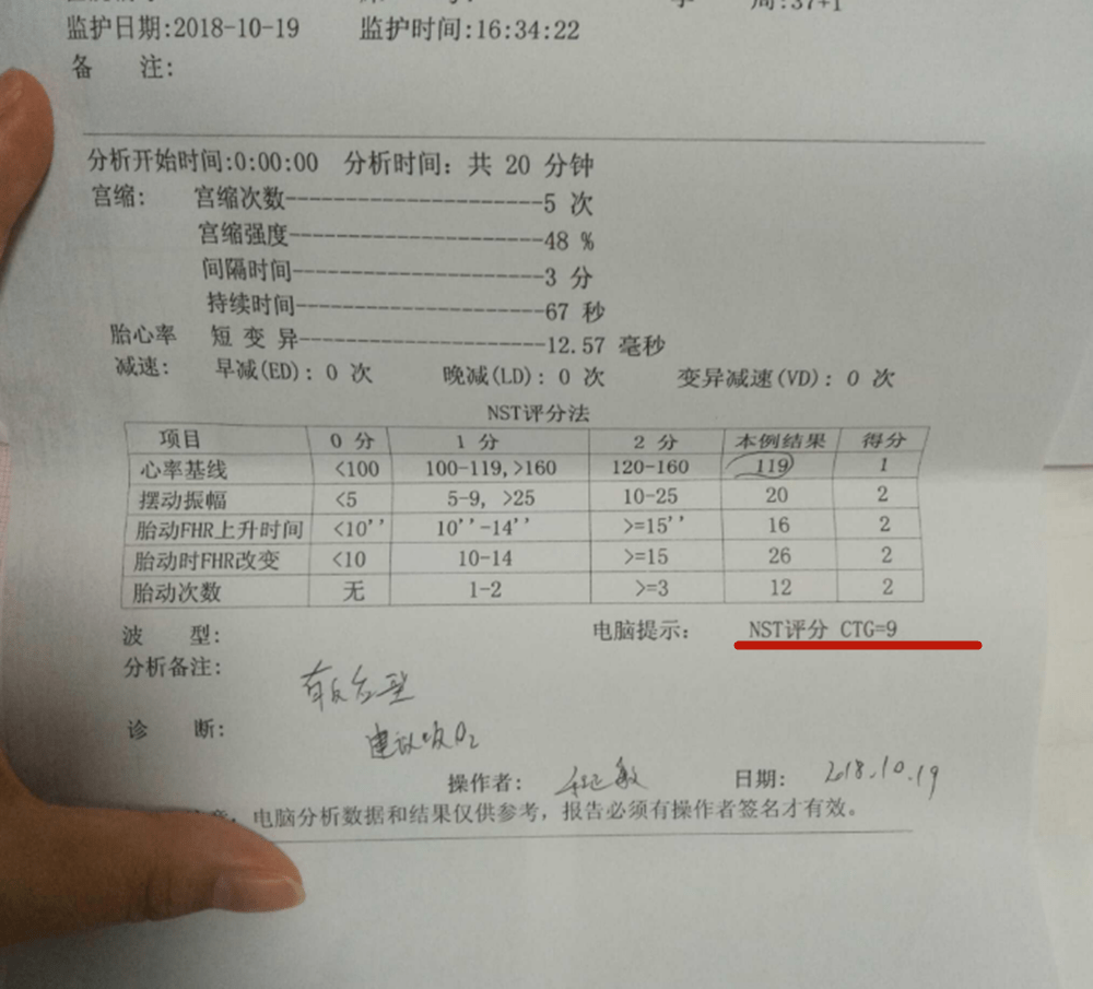 两个月宝宝心跳正常值解析